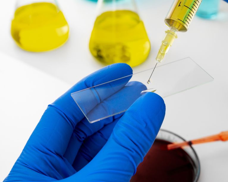 EXÁMENES BIOQUIMICOS
